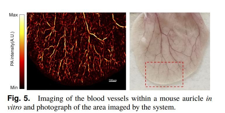 The Application of Microchip Laser In Photoacoustic Imaging