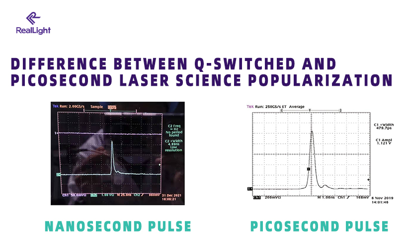 The Difference Between Q-Switched and Picosecond Lasers