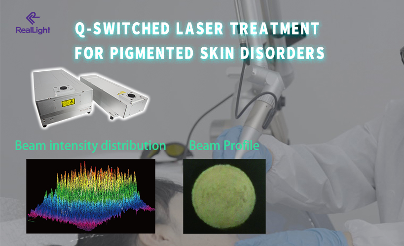 Q-Switched Laser Treatment for Pigmented Skin Disorders