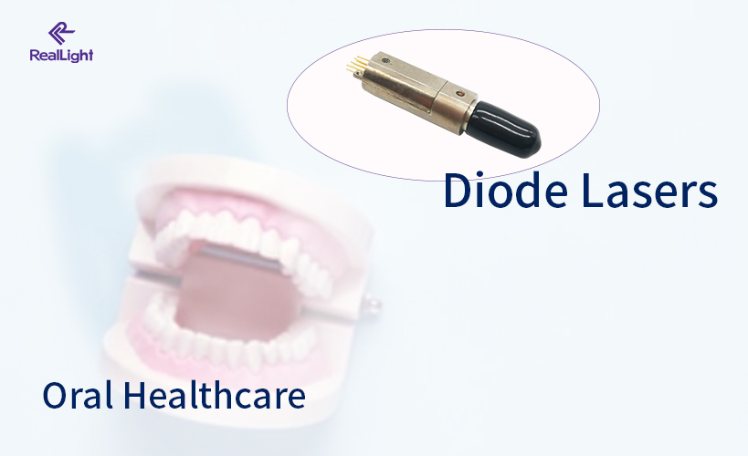 Applications of Diode Lasers in Oral Healthcare